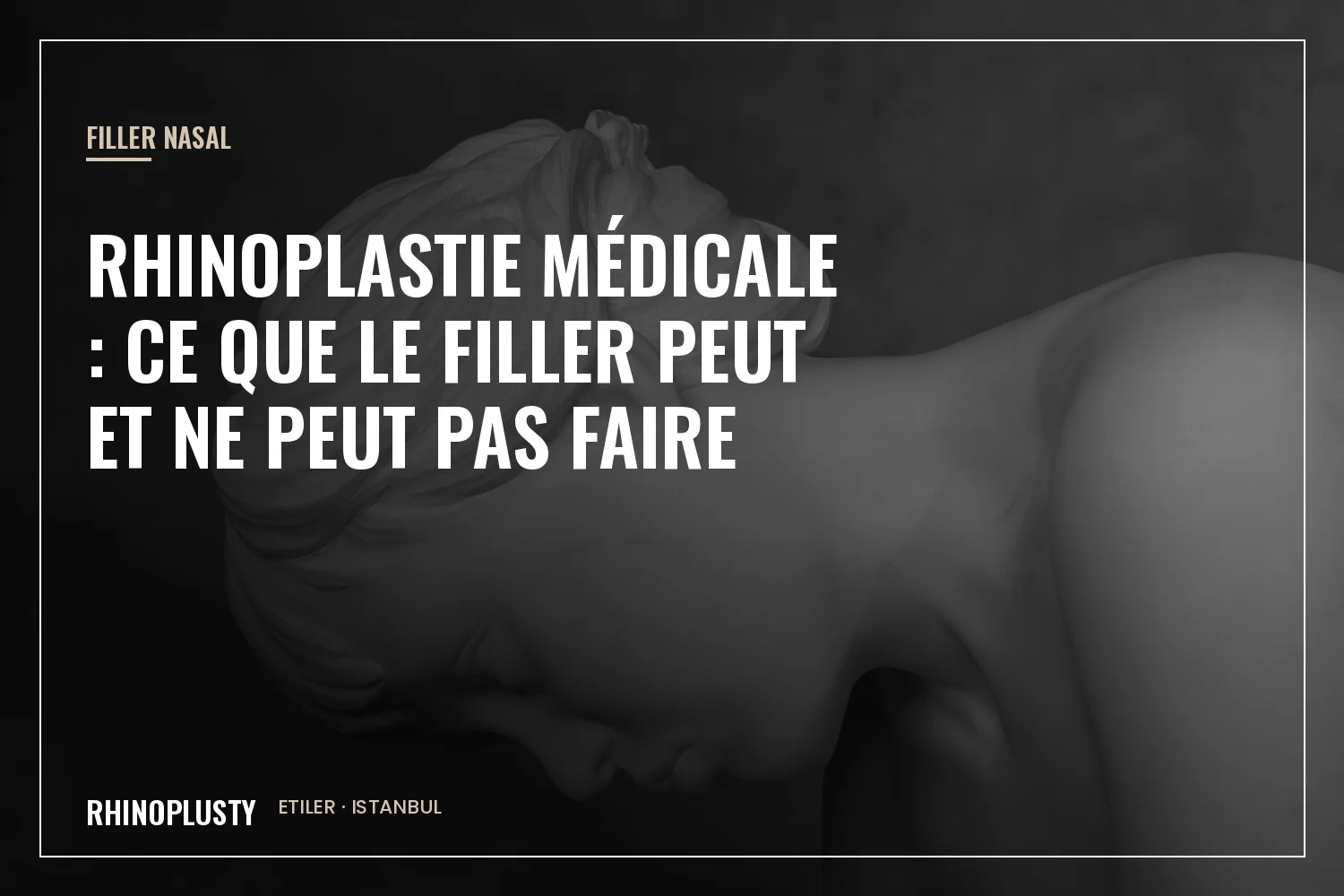 Consultation sur les limites du filler nasal