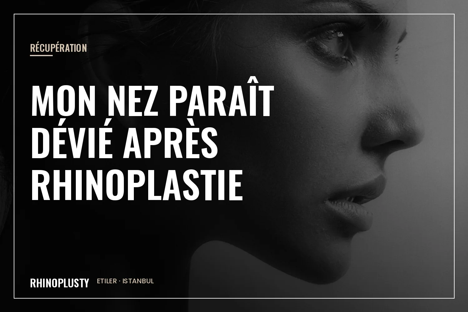 Profil élégant d'une femme avec une arête nasale délicate