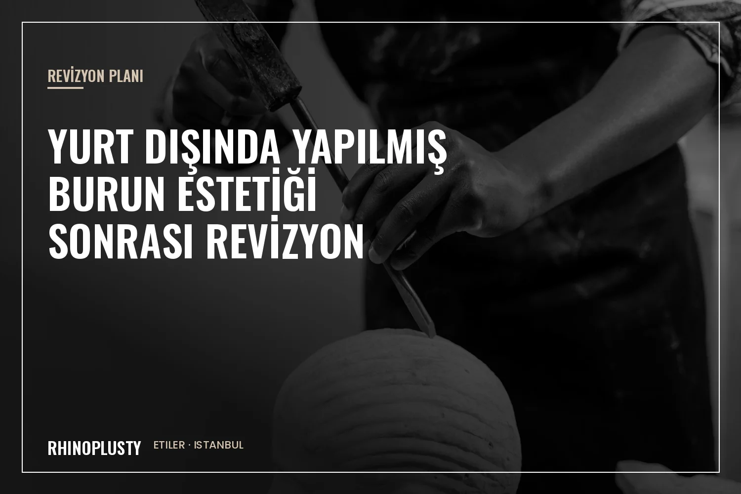 Revizyon planlamasına ait tıbbi notların yanında klasik burun heykeli profili