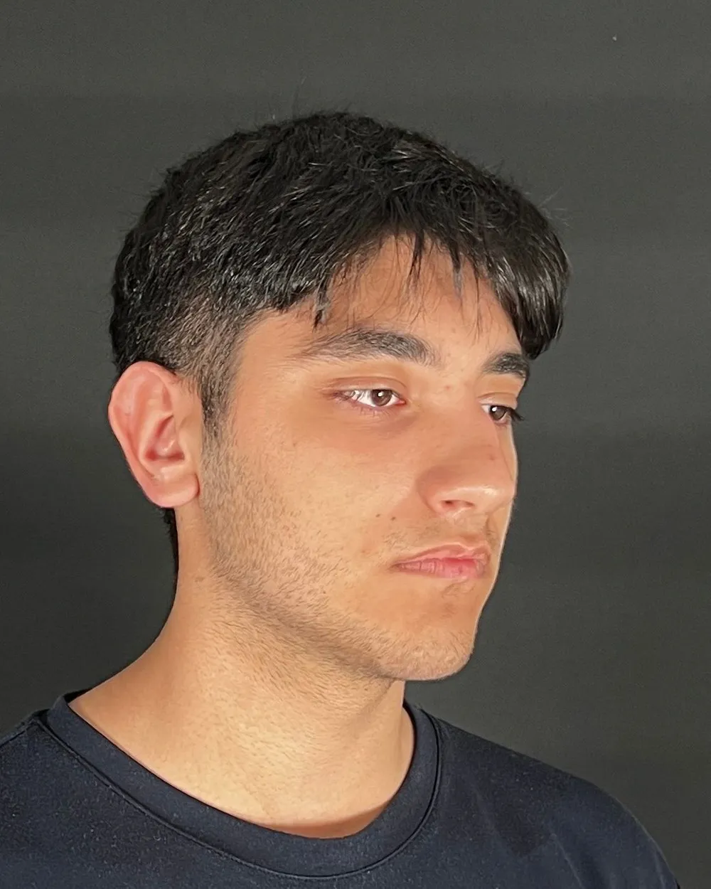 Öncesi: Primer rinoplasti, Yarım profil