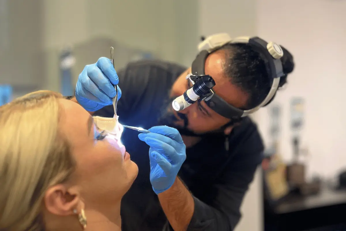 Septorhinoplasty — before and after