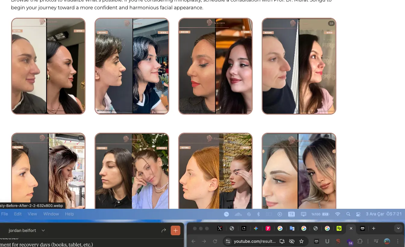 Rhinoplusty clinic, Etiler Istanbul